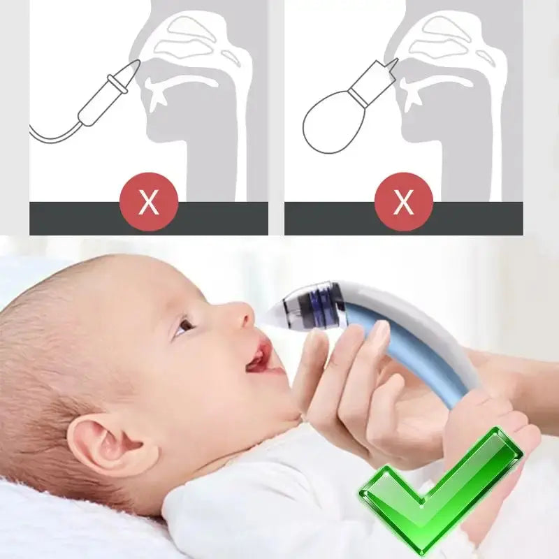 Baby Electric Nasal Aspirator GLR SHOPPING
