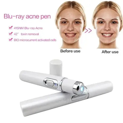 Wrinkle Pore Remover Pen GLR SHOPPING