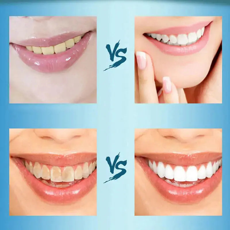 Teeth Whitening Powder GLR SHOPPING