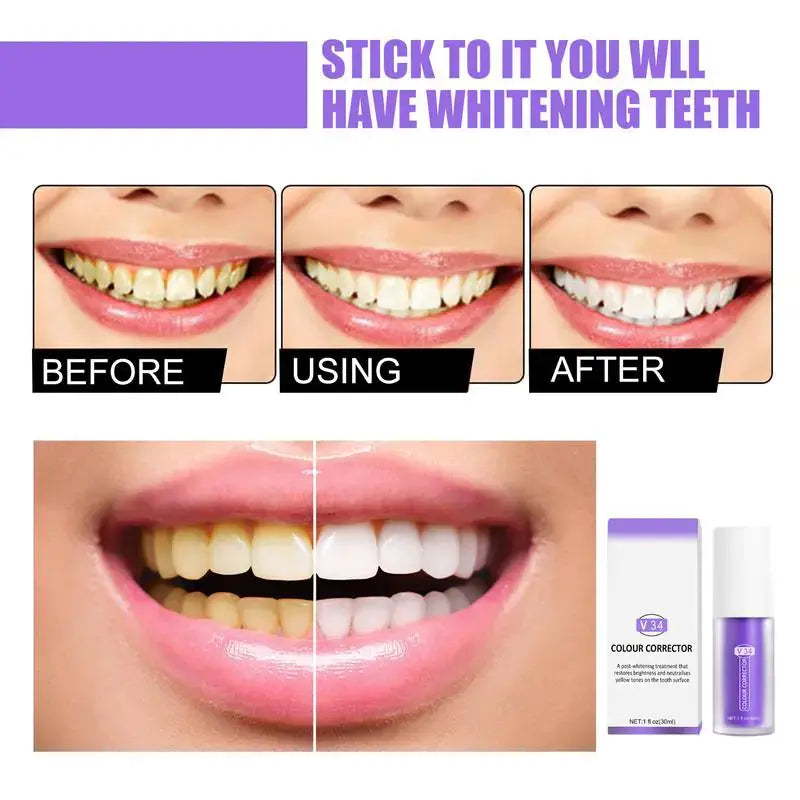 Teeth Intensive Whitening Toothpaste GLR SHOPPING