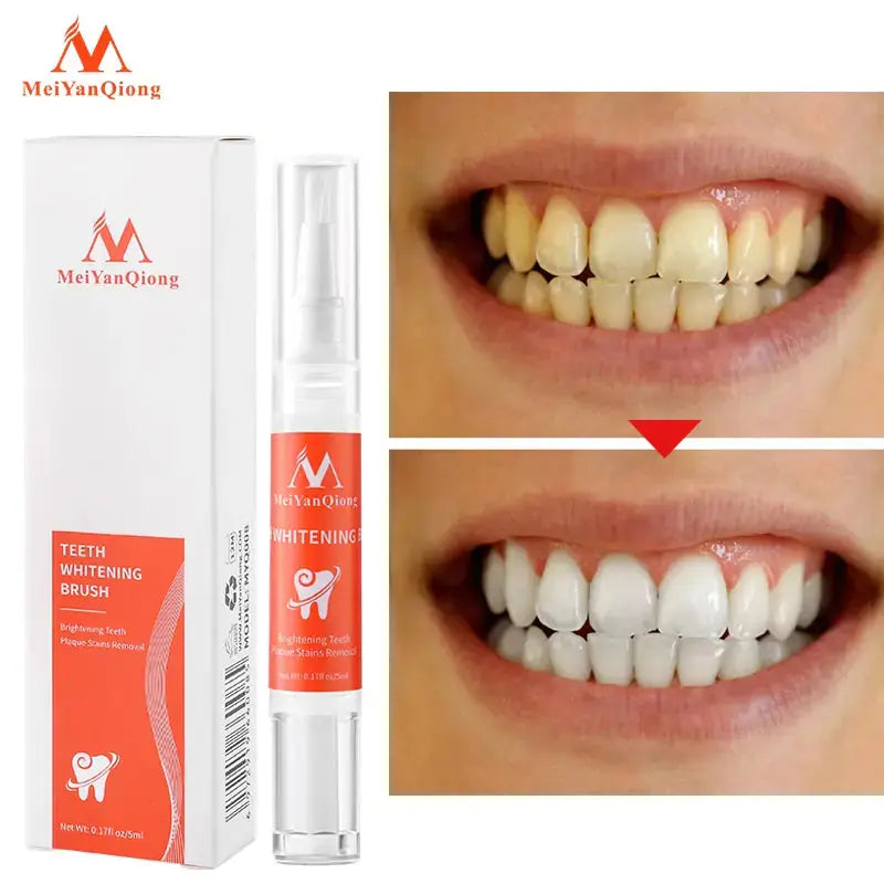 Teeth Whitening Pen GLR SHOPPING