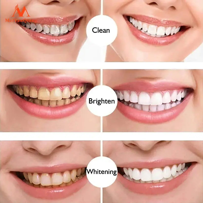 Teeth Whitening Pen GLR SHOPPING