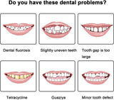 Silicone False Teeth Instant Smile