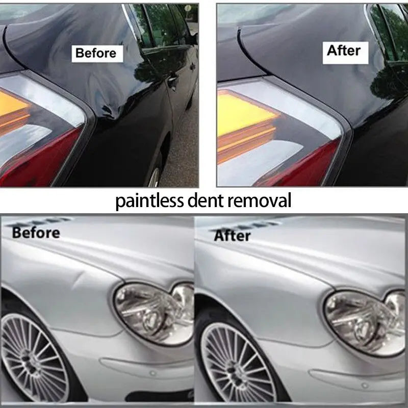 Dent Repair Tool - GLR SHOPPING