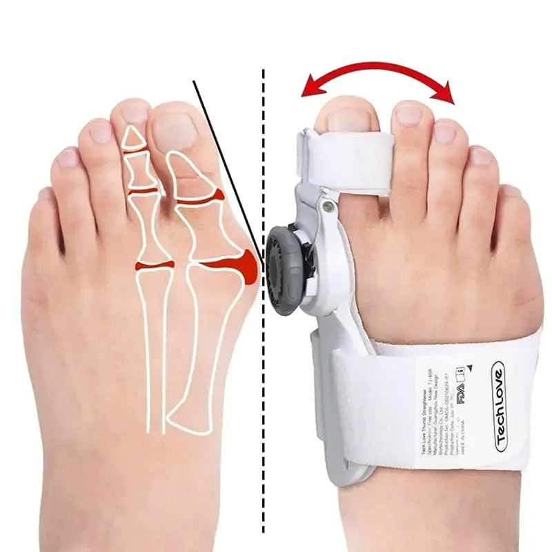 Adjustable Bunion Corrector GLR SHOPPING