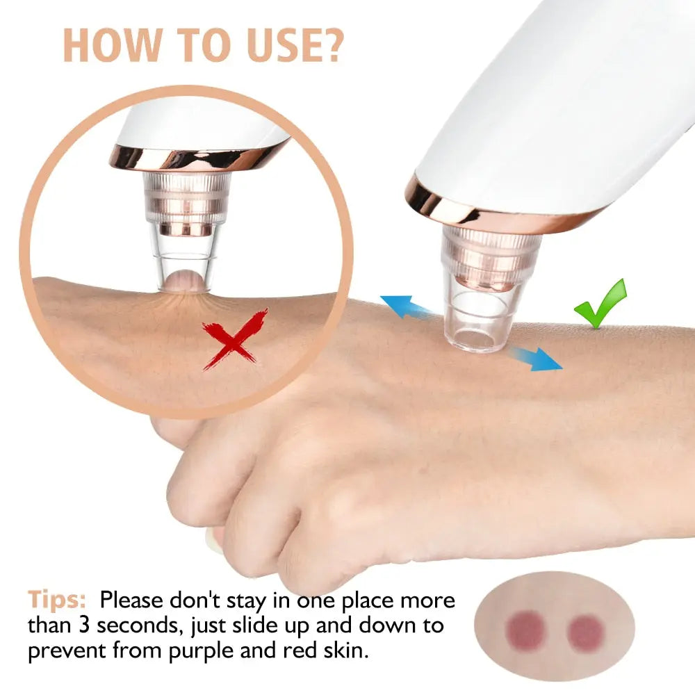 Vacuum Electric Blackhead Remover Cleaner - GLR SHOPPING