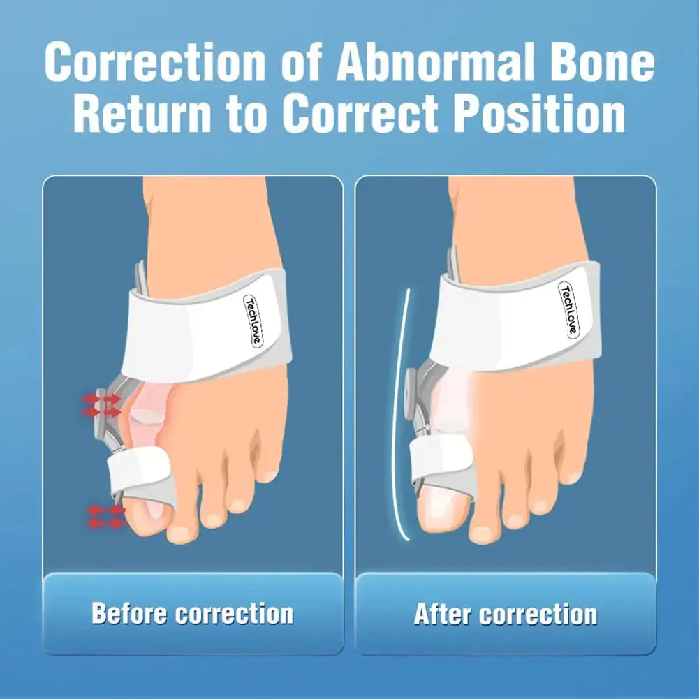 Adjustable Bunion Corrector GLR SHOPPING